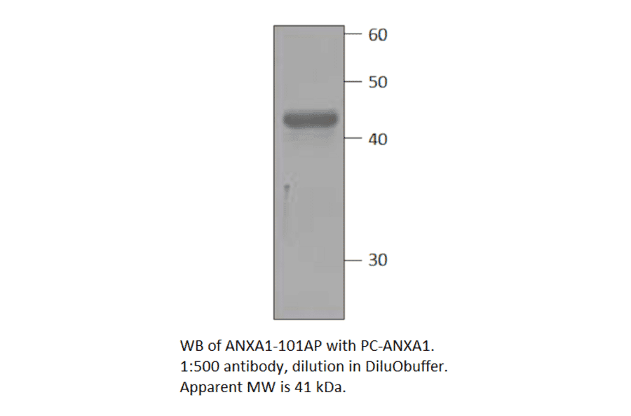 Anti-Annexin A1 Antibody from FabGennix (ANXA1-101AP) - Antibodies.com