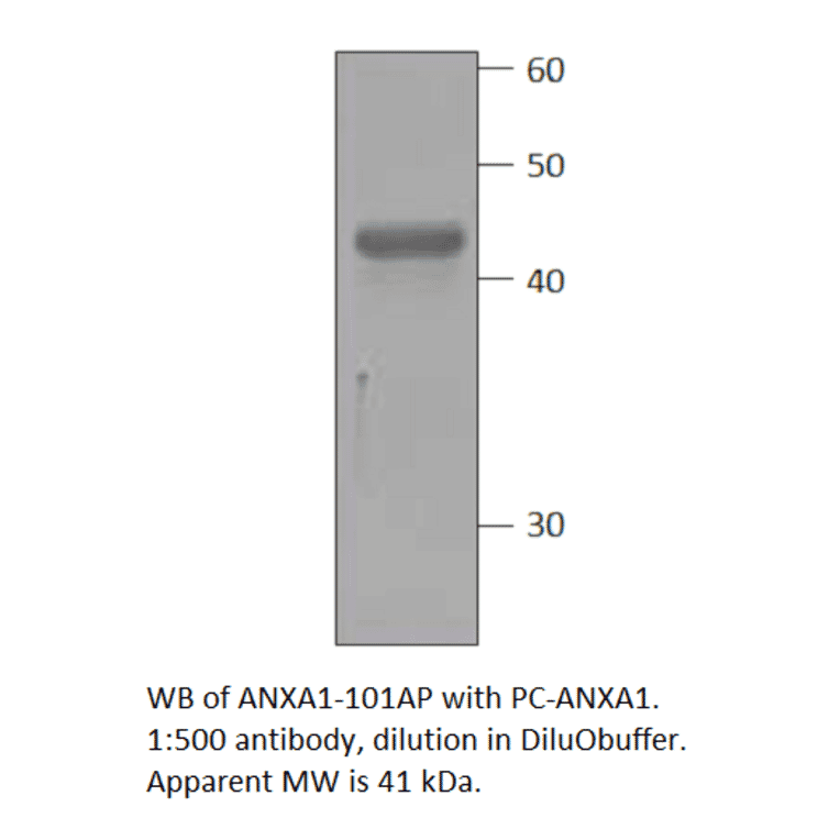 Anti-Annexin A1 Antibody from FabGennix (ANXA1-101AP) - Antibodies.com