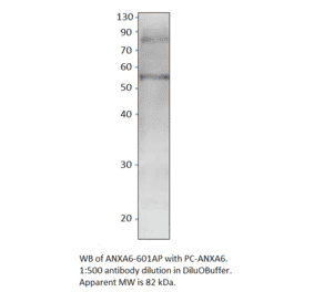 Anti-Annexin A6 Antibody from FabGennix (ANXA6-601AP) - Antibodies.com