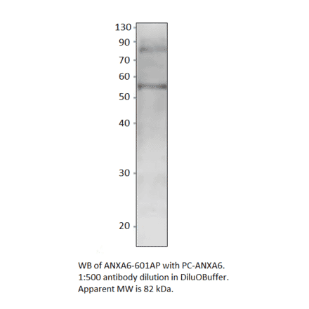 Anti-Annexin A6 Antibody from FabGennix (ANXA6-601AP) - Antibodies.com