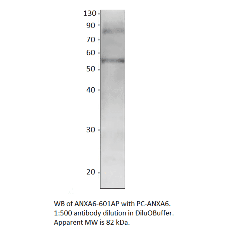 Anti-Annexin A6 Antibody from FabGennix (ANXA6-601AP) - Antibodies.com