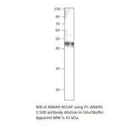 Anti-Annexin A9 Antibody from FabGennix (ANXA9-901AP) - Antibodies.com