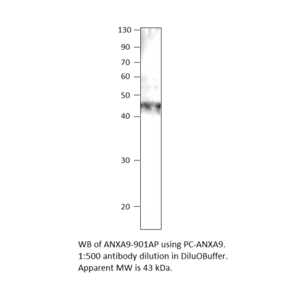 Anti-Annexin A9 Antibody from FabGennix (ANXA9-901AP) - Antibodies.com