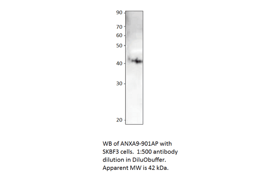 Anti-Annexin A9 Antibody from FabGennix (ANXA9-901AP) - Antibodies.com