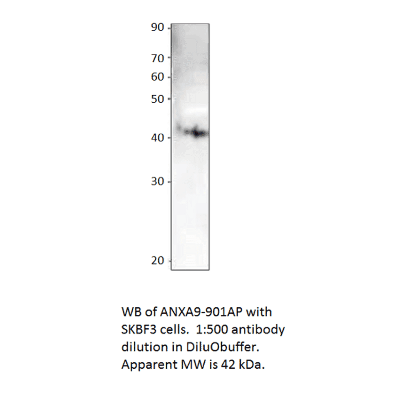 Anti-Annexin A9 Antibody from FabGennix (ANXA9-901AP) - Antibodies.com