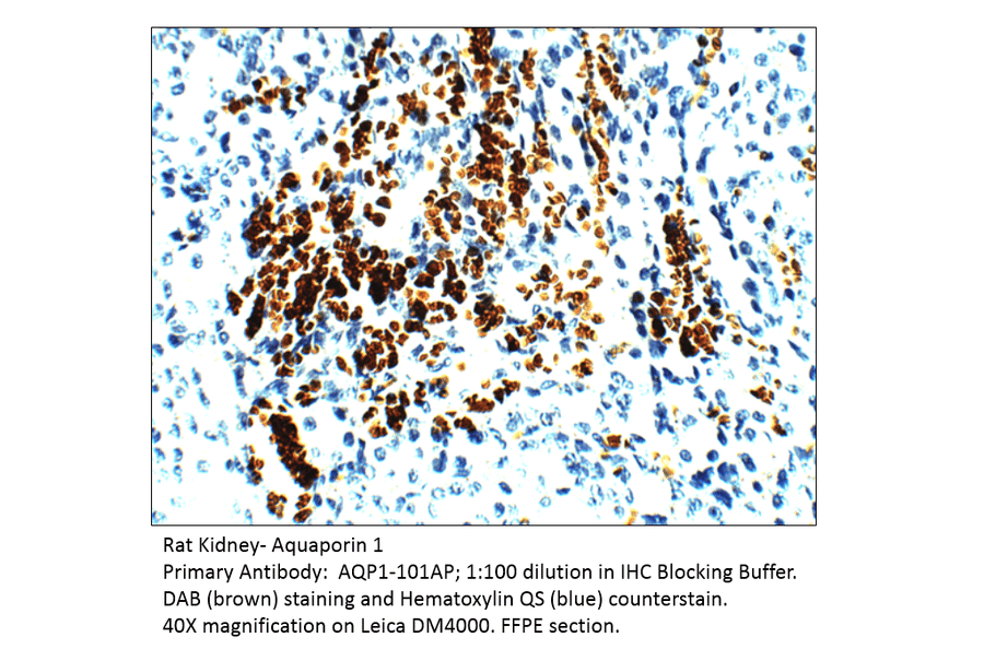 Anti-Aquaporin 1 Antibody from FabGennix (AQP1-101AP) - Antibodies.com