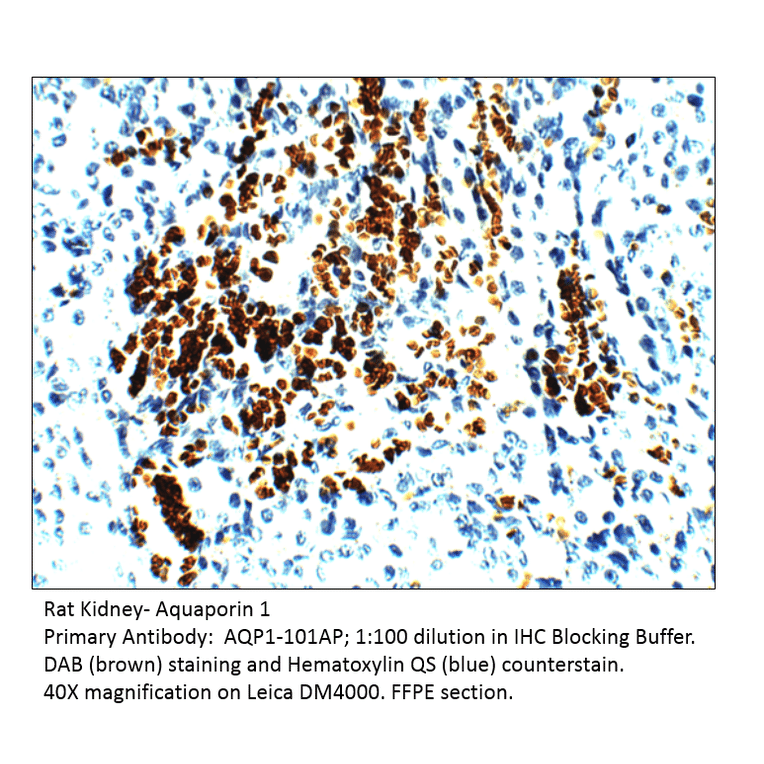 Anti-Aquaporin 1 Antibody from FabGennix (AQP1-101AP) - Antibodies.com