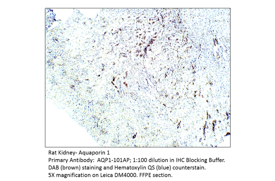 Anti-Aquaporin 1 Antibody from FabGennix (AQP1-101AP) - Antibodies.com