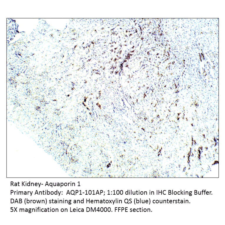 Anti-Aquaporin 1 Antibody from FabGennix (AQP1-101AP) - Antibodies.com