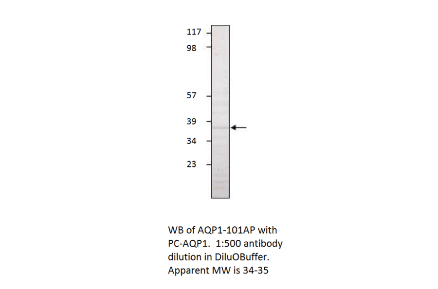 Anti-Aquaporin 1 Antibody from FabGennix (AQP1-101AP) - Antibodies.com