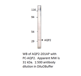 Anti-Aquaporin 2 Antibody from FabGennix (AQP2-201AP) - Antibodies.com