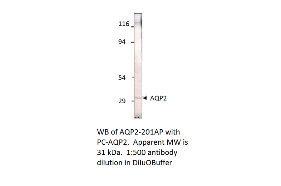 Anti-Aquaporin 2 Antibody from FabGennix (AQP2-201AP) - Antibodies.com