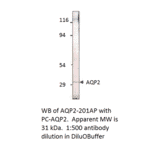 Anti-Aquaporin 2 Antibody from FabGennix (AQP2-201AP) - Antibodies.com