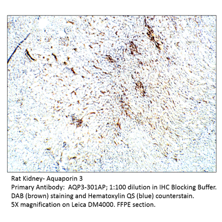 Anti-Aquaporin 3 Antibody from FabGennix (AQP3-301AP) - Antibodies.com