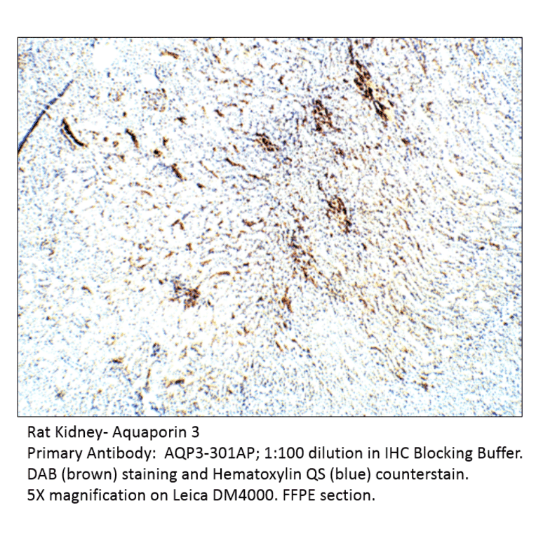 Anti-Aquaporin 3 Antibody from FabGennix (AQP3-301AP) - Antibodies.com