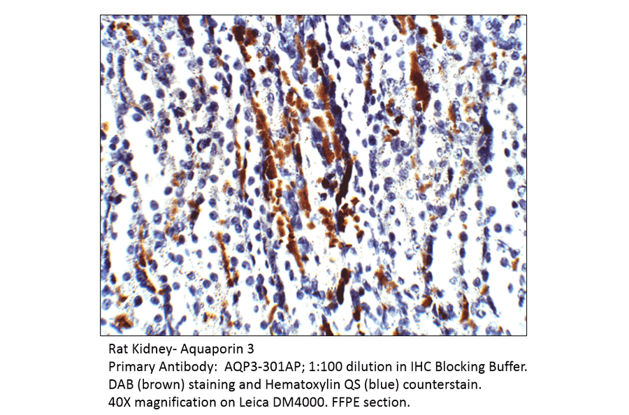 Anti-Aquaporin 3 Antibody from FabGennix (AQP3-301AP) - Antibodies.com