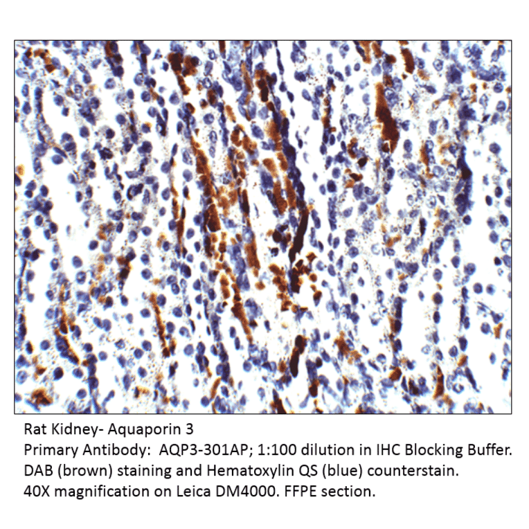 Anti-Aquaporin 3 Antibody from FabGennix (AQP3-301AP) - Antibodies.com