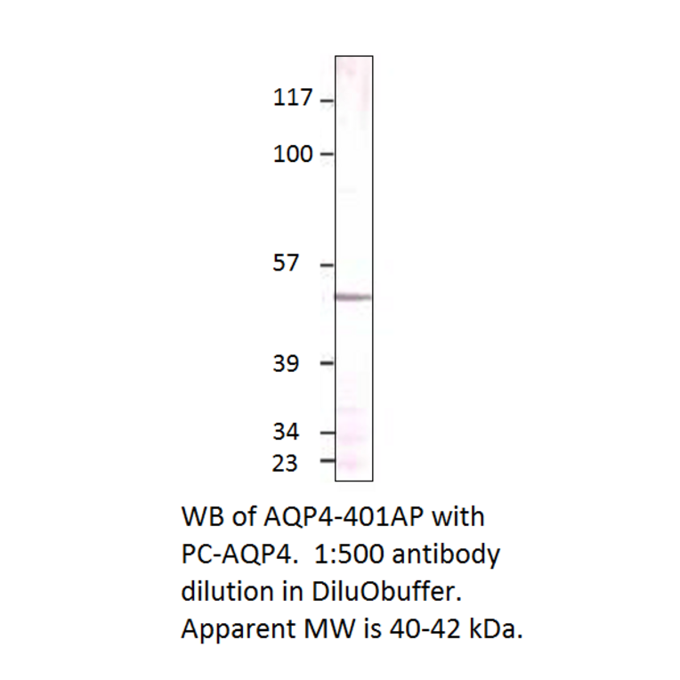 Anti-Aquaporin 4 Antibody from FabGennix (AQP4-401AP) - Antibodies.com