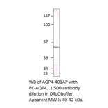 Anti-Aquaporin 4 Antibody from FabGennix (AQP4-401AP) - Antibodies.com