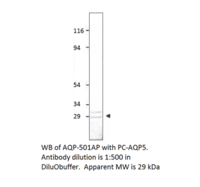 Anti-Aquaporin 5 Antibody from FabGennix (AQP5-501AP) - Antibodies.com