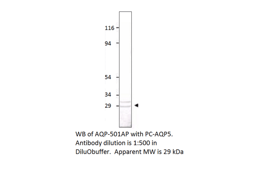 Anti-Aquaporin 5 Antibody from FabGennix (AQP5-501AP) - Antibodies.com