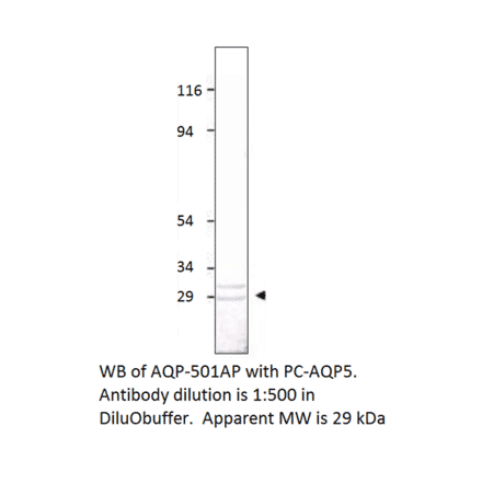 Anti-Aquaporin 5 Antibody from FabGennix (AQP5-501AP) - Antibodies.com