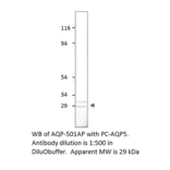 Anti-Aquaporin 5 Antibody from FabGennix (AQP5-501AP) - Antibodies.com