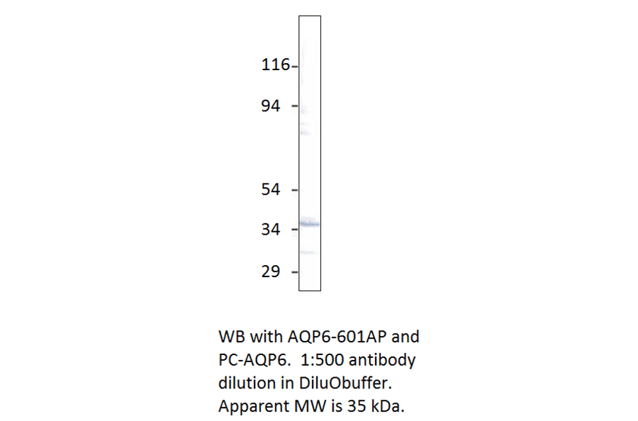 Anti-Aquaporin 6 Antibody from FabGennix (AQP6-601AP) - Antibodies.com