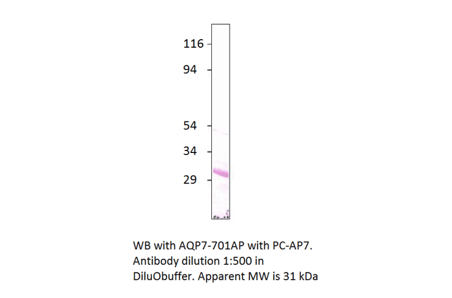 Anti-Aquaporin 7 Antibody from FabGennix (AQP7-701AP) - Antibodies.com