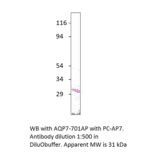 Anti-Aquaporin 7 Antibody from FabGennix (AQP7-701AP) - Antibodies.com