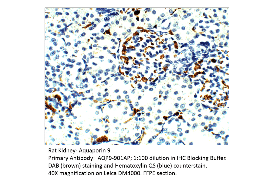 Anti-Aquaporin 9 Antibody from FabGennix (AQP9-901AP) - Antibodies.com