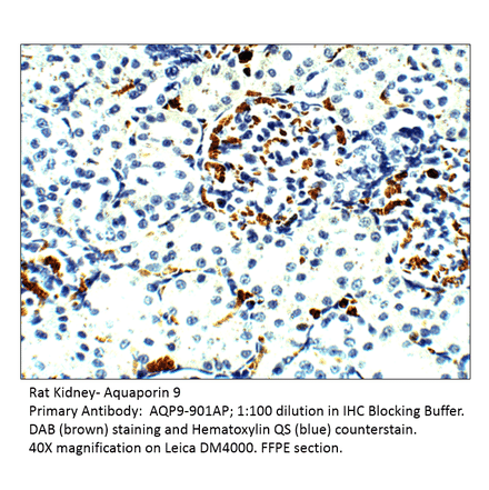 Anti-Aquaporin 9 Antibody from FabGennix (AQP9-901AP) - Antibodies.com