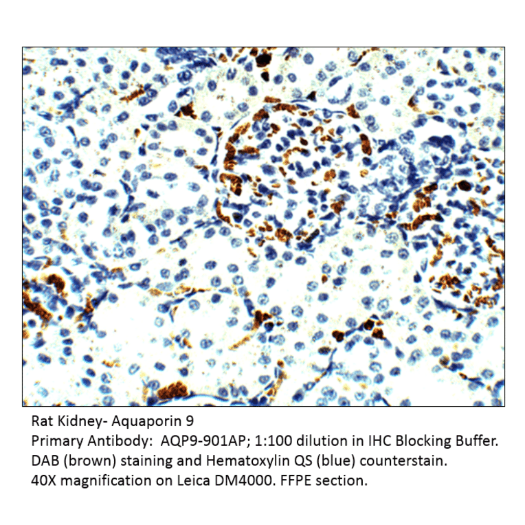 Anti-Aquaporin 9 Antibody from FabGennix (AQP9-901AP) - Antibodies.com