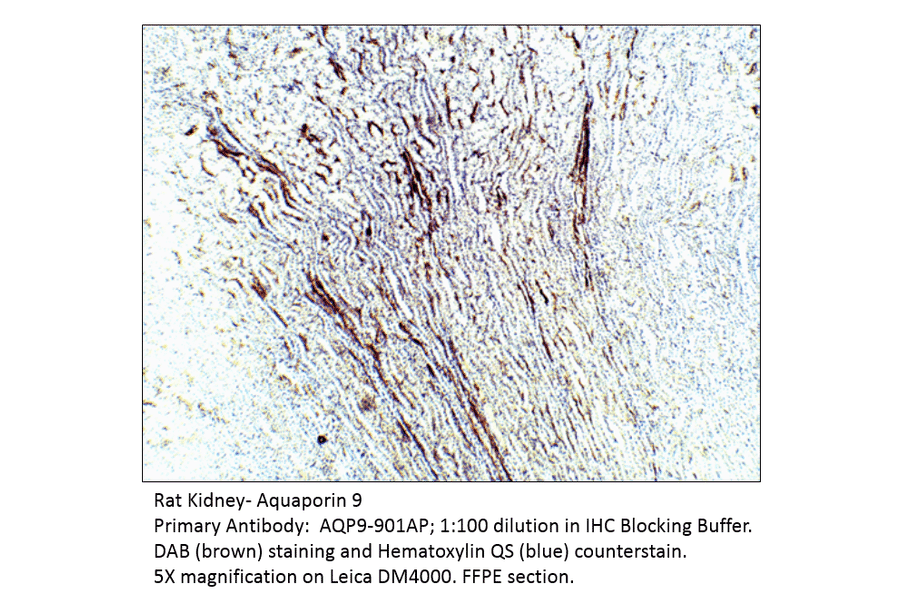 Anti-Aquaporin 9 Antibody from FabGennix (AQP9-901AP) - Antibodies.com