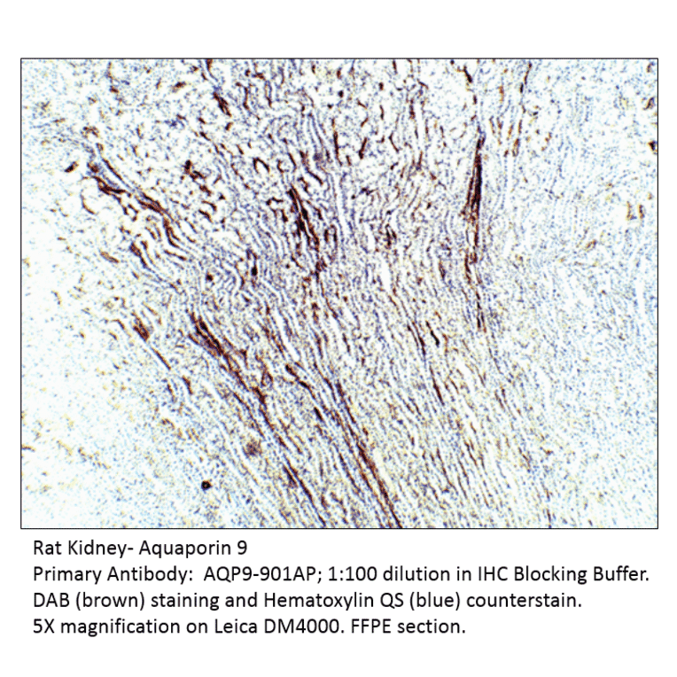 Anti-Aquaporin 9 Antibody from FabGennix (AQP9-901AP) - Antibodies.com
