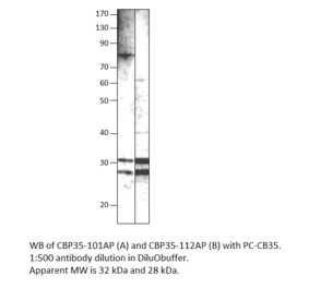 Anti-Galectin 3 Antibody from FabGennix (CBP35-101AP) - Antibodies.com