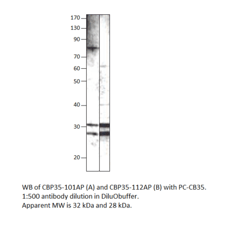 Anti-Galectin 3 Antibody from FabGennix (CBP35-101AP) - Antibodies.com