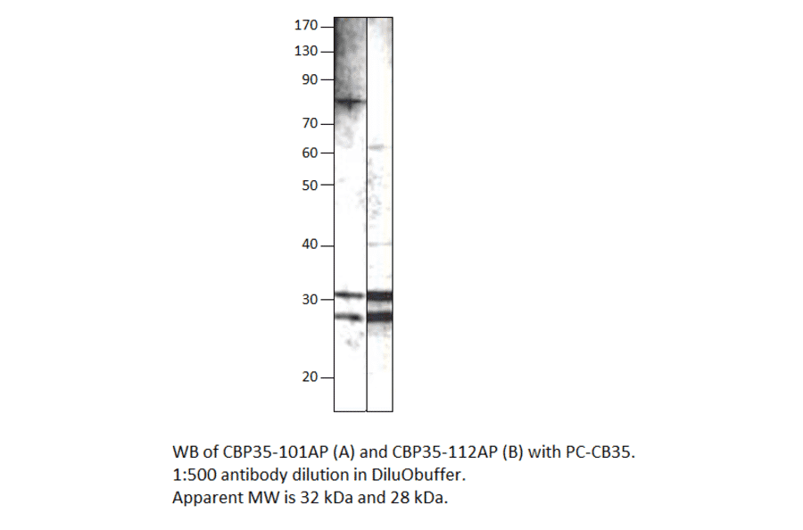 Anti-Galectin 3 Antibody from FabGennix (CBP35-112AP) - Antibodies.com