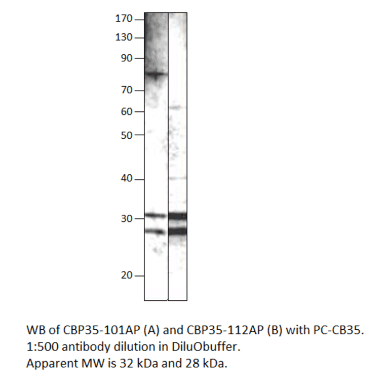Anti-Galectin 3 Antibody from FabGennix (CBP35-112AP) - Antibodies.com
