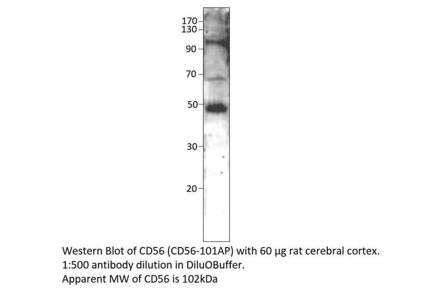 Anti-CD56 / NCAM Antibody from FabGennix (CD56-101AP) - Antibodies.com