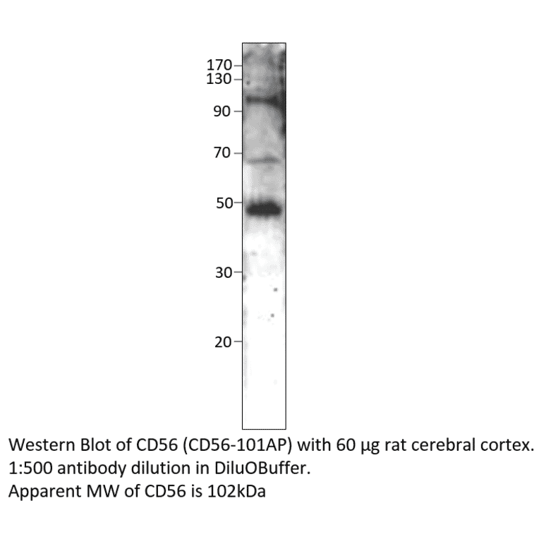Anti-CD56 / NCAM Antibody from FabGennix (CD56-101AP) - Antibodies.com