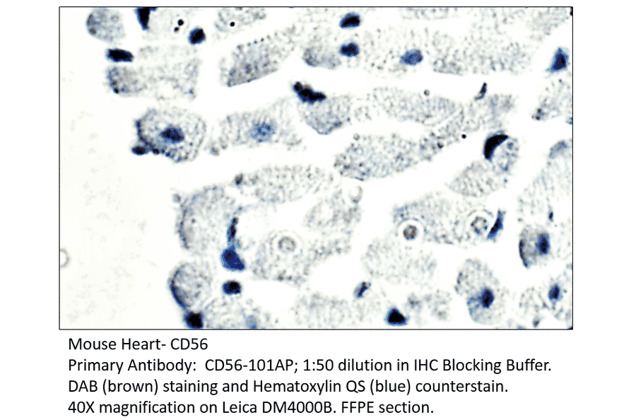 Anti-CD56 / NCAM Antibody from FabGennix (CD56-101AP) - Antibodies.com