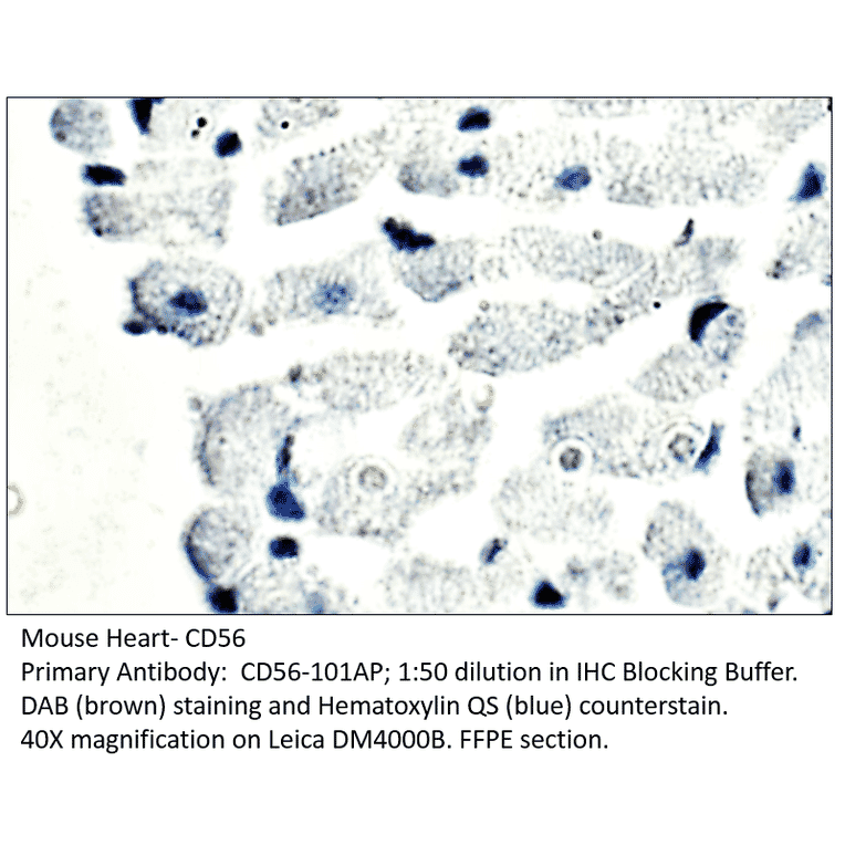 Anti-CD56 / NCAM Antibody from FabGennix (CD56-101AP) - Antibodies.com