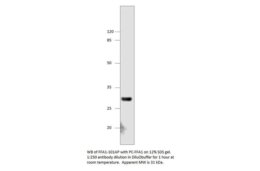 Anti-GPCR GPR40 Antibody from FabGennix (FFAR1-101AP) - Antibodies.com