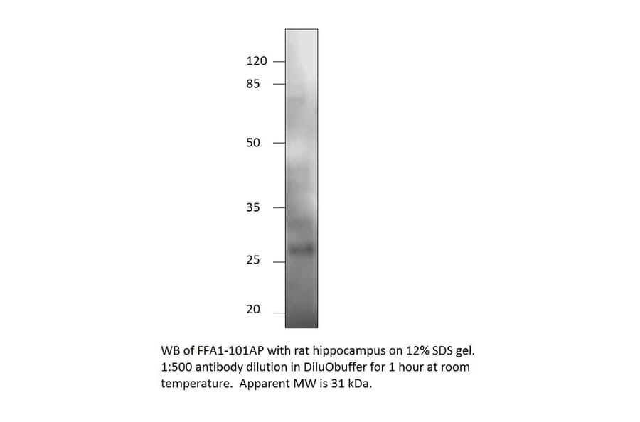 Anti-GPCR GPR40 Antibody from FabGennix (FFAR1-101AP) - Antibodies.com