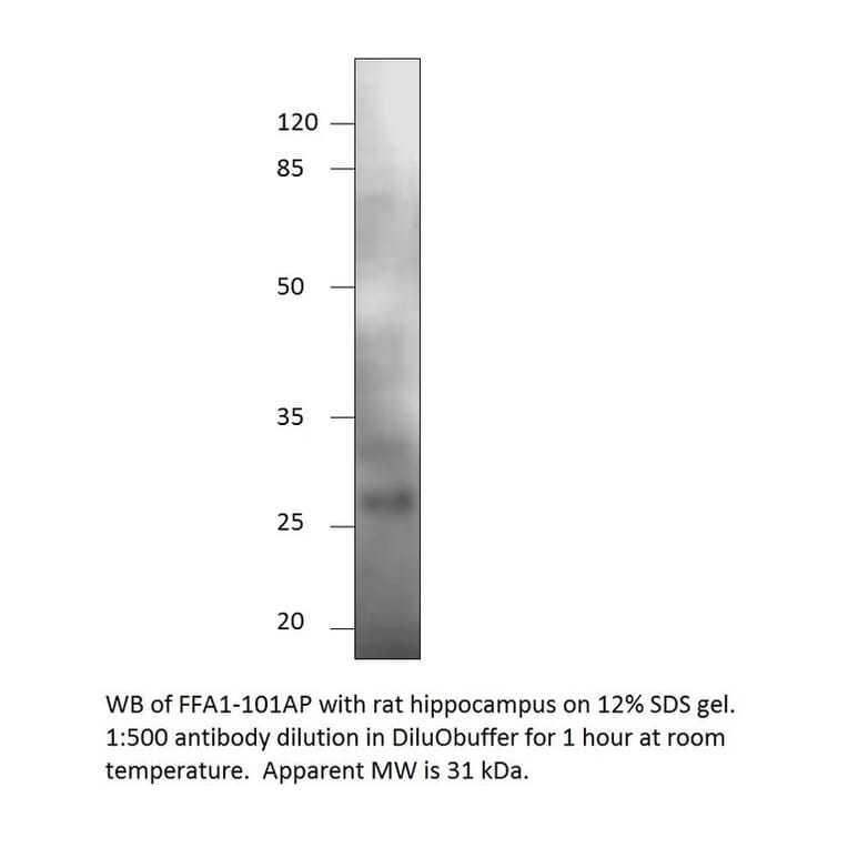 Anti-GPCR GPR40 Antibody from FabGennix (FFAR1-101AP) - Antibodies.com
