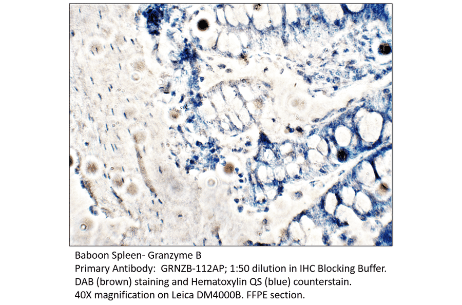 Anti-Granzyme B Antibody from FabGennix (GRNZB-112AP) - Antibodies.com