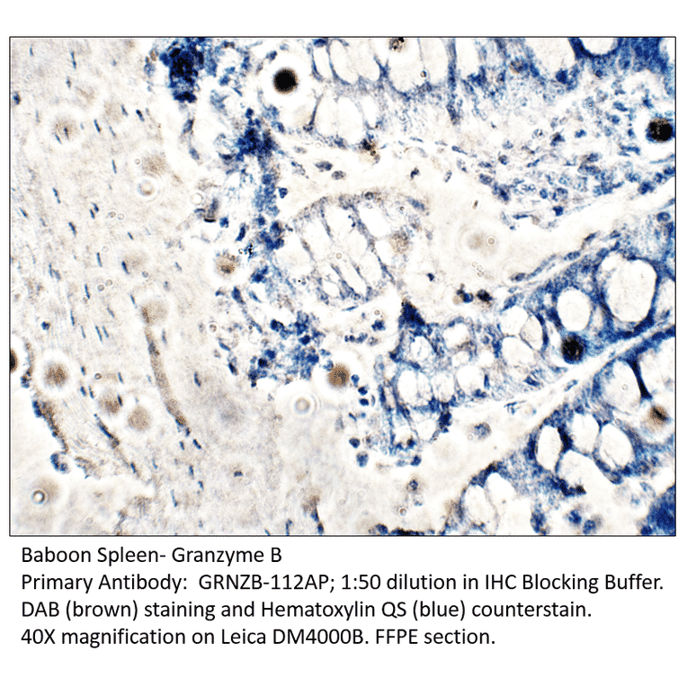 Anti-Granzyme B Antibody from FabGennix (GRNZB-112AP) - Antibodies.com