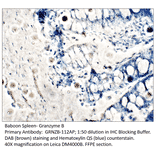 Anti-Granzyme B Antibody from FabGennix (GRNZB-112AP) - Antibodies.com