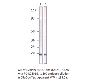 Anti-IL23 P19 Antibody from FabGennix (IL23P19-101AP) - Antibodies.com